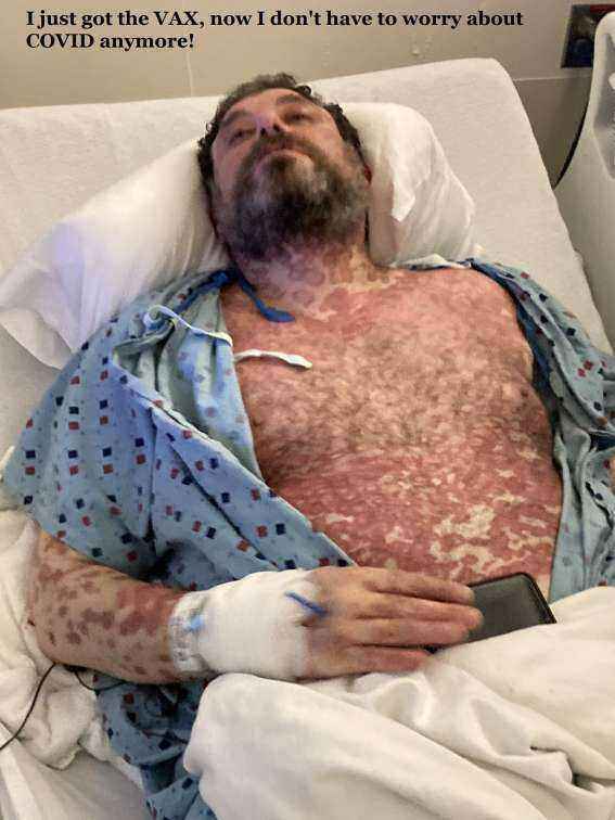 Rash.thumb.jpg.75c0a5cde792faf58d5c272e1b9e671a.jpg
